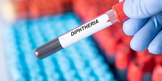 Diphtérie au Maroc : 30 cas confirmés et deux décès au Maroc